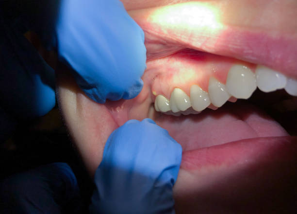 Best Emergency Dentist for Knocked-Out Tooth in Manhattan, IL